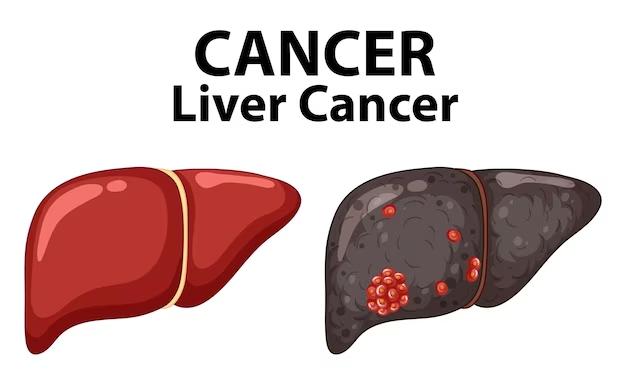 Liver cancer treatment 
